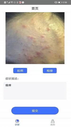 可以拍照识别皮肤病的<a href=https://www.bangqike.com/caijing/121413.html target=_blank class=infotextkey>软件</a>(拍一拍识别皮肤病<a href=https://www.bangqike.com/caijing/121413.html target=_blank class=infotextkey>软件</a>排行榜有哪些哪个好用)